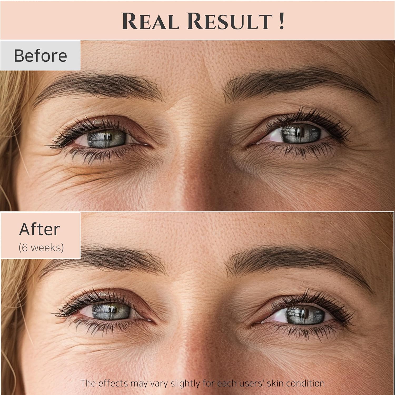 Beauty of Joseon: Revive Eye Serum with Retinal Niacinamide Correction for Puffy Eye Bags Fine Lines Dark Circles Wrinkles, Korean Skin Care 30Ml, 1 Fl.Oz